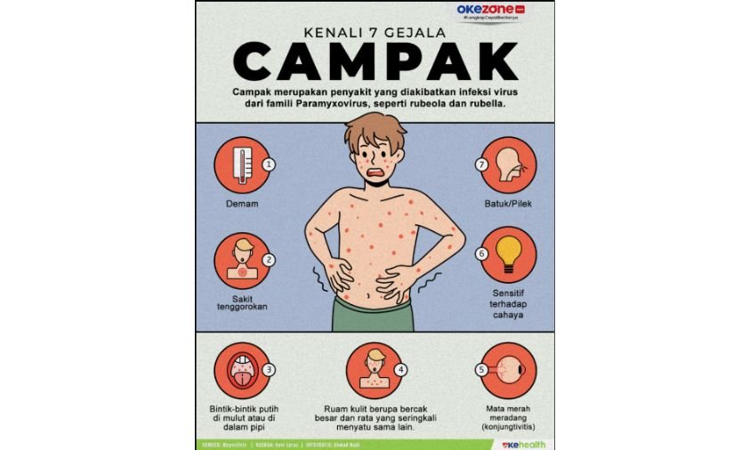 Gejala Campak