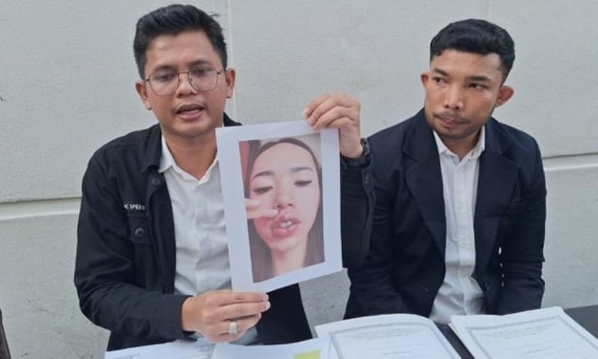 Korban Ex Finalis Putri Indonesia 2024