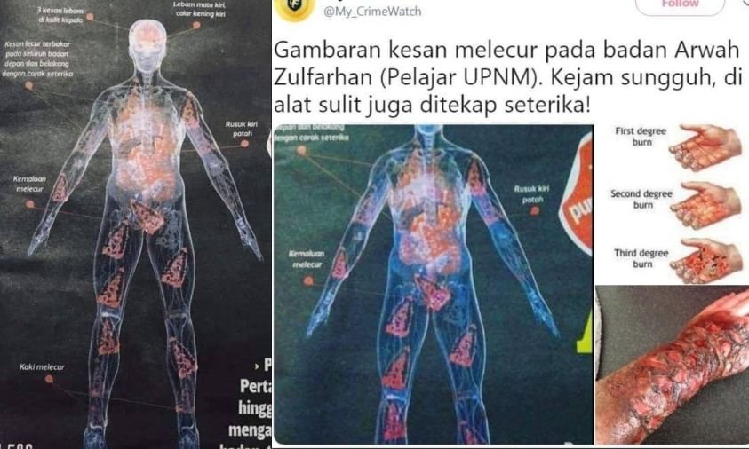 Kasus Zulfarhan